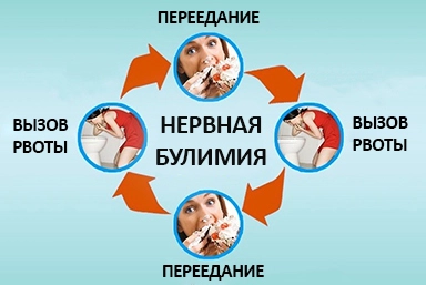 Лечение булимии в Козьмодемьянске